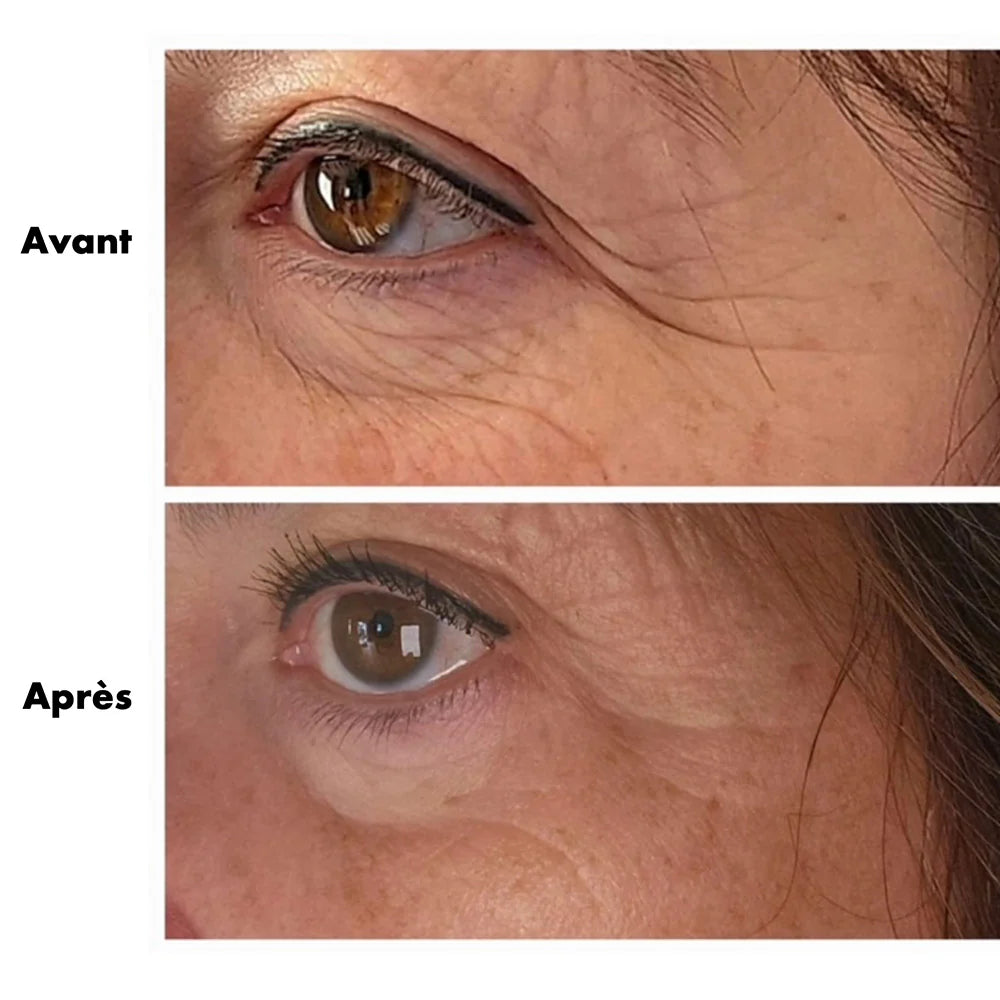 Gel Fermeté DERMA ELASTIN