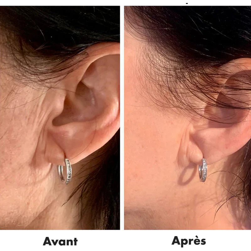 Gel Fermeté DERMA ELASTIN