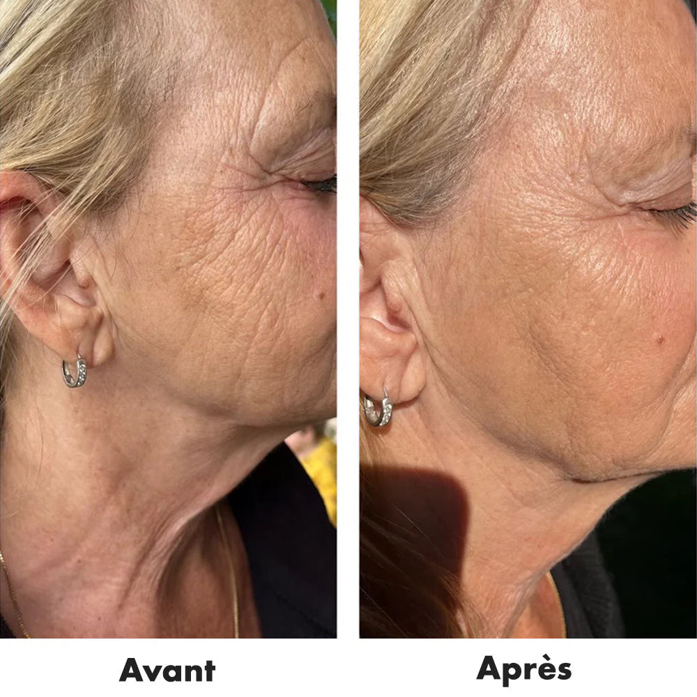 Gel Fermeté DERMA ELASTIN